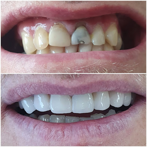 Prije i poslije dentalnog rada Dental Mimica